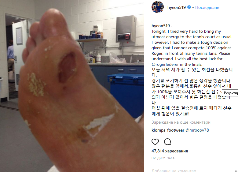 Хьон Чун показа снимка на травмата си