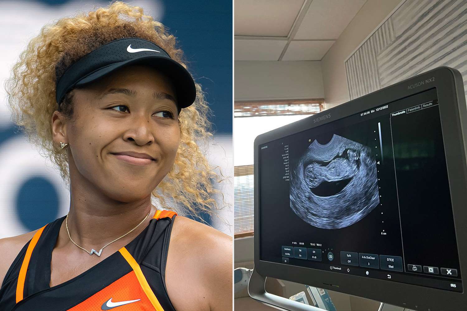 Бейби бум в WTA Tура: Осака също разкри, че е бременна и няма да играе през 2023-та
